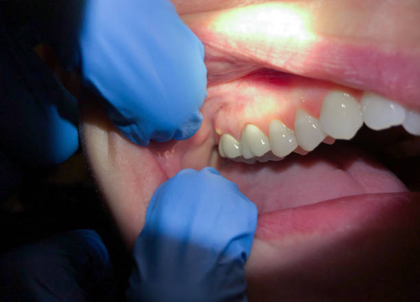 Best Emergency Pediatric Dental Care in Lewistown, IL